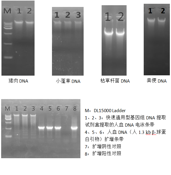 快速通用型基因組DNA提取試劑盒-2×PCR Mix-溶菌酶-電泳結(jié)果圖一