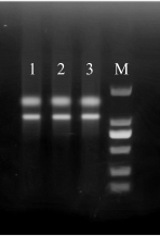 Simgen高多糖多酚植物總RNA試劑盒-DNase Ⅰ柱上消化試劑盒-提取閩楠葉片RNA電泳結(jié)果圖