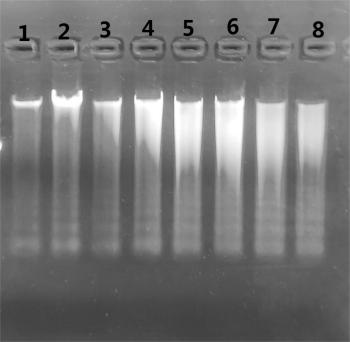 Simgen在1%的瓊脂糖凝膠上加入5 μl洗脫的唾液DNA進(jìn)行電泳結(jié)果圖一