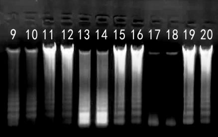 Simgen在1%的瓊脂糖凝膠上加入5 μl洗脫的唾液DNA進(jìn)行電泳結(jié)果圖二